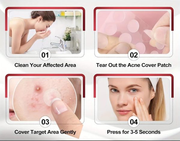 ⁦Pimple Patch, 360 Pieces, Ultra Thin, Waterproof, Protective Cover, Invisible⁩ - الصورة ⁦5⁩