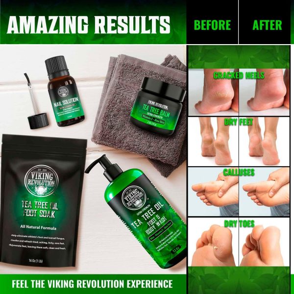 1733022195 Viking Revolution Athletes Foot Treatment Extra Strength Foot Cure Kit Includes Tea Tree Body Wash Tea Tree Balm Foot Soak Toenail Treatment