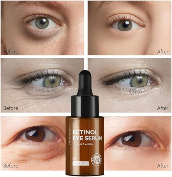 ⁦Retinol Eye Serum30mL and Retinol Face Cream 30g combination is silky and rich in active Vitamin A (Retinol) reduce the appearance of fine lines, wrinkles, and eye bags, smooth and firm the eye skin.⁩ - الصورة ⁦3⁩