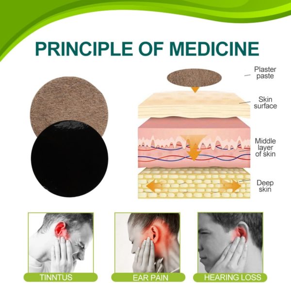 ⁦رقع تخفيف طنين الاذن من هونبولو - عبوة 12 قطعة فعال لطنين والدوار نقاط الوخز بالإبر للاذن والسمع تخفف الرنين في الاذنين تقلل الدوخة تدعم صحة السمع الراحة كل الأنواع⁩ - الصورة ⁦4⁩