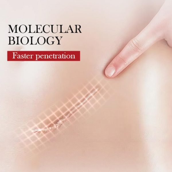 كريم جل متطور للندوب الجراحية وعلامات التمدد وحب الشباب والاصابات والجدرة واكثر - ذلك فعال لكل - الندوب القديمة والجديدة - الميكاكوز احترافي لازالة 3