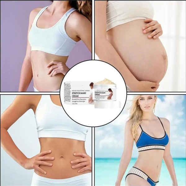 ⁦اكسيفور كريم منع علامات التمدد للحمل، كريم مزيل علامات التمدد، كريم علامات التمدد لتدليك الجسم أثناء الحمل، يقلل من ظهور الندبات، العناية ببشرة البطن قبل الولادة وبعدها⁩ - الصورة ⁦7⁩