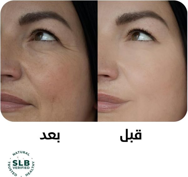 ⁦سيروم الفيلر بالإنزيم لشد وامتلاء البشرة للبشرة المتعبة والمرهقة بجميع أنواعها (30 مل)⁩ - الصورة ⁦4⁩