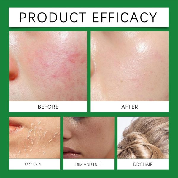 ⁦Azonee Aloe Vera Gel for Skin & Hair, Soothing Gel Moisturizer for Face and Body, Lightweight Non-Sticky Aloe Gel for Sunburn Relief and After Sun Care (100ml)⁩ - الصورة ⁦3⁩