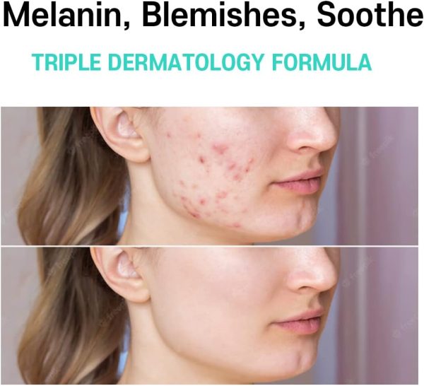 ⁦CARE:NEL Melasma Treatment for Face Cream - Dark Spot Remover Centella Asiatica - Korean Skin Care Beauty Products 40ml/1.35 fl.oz⁩ - الصورة ⁦3⁩