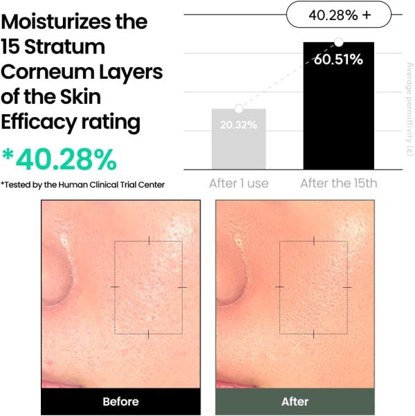 ⁦Liposome Waterful Bubble Toner, Moisturizing Foaming Toner for Sensitive Skin with Centella Asiatica TECA, Korean Skincare for Problem Skin (150ml 150ml)⁩ - الصورة ⁦6⁩