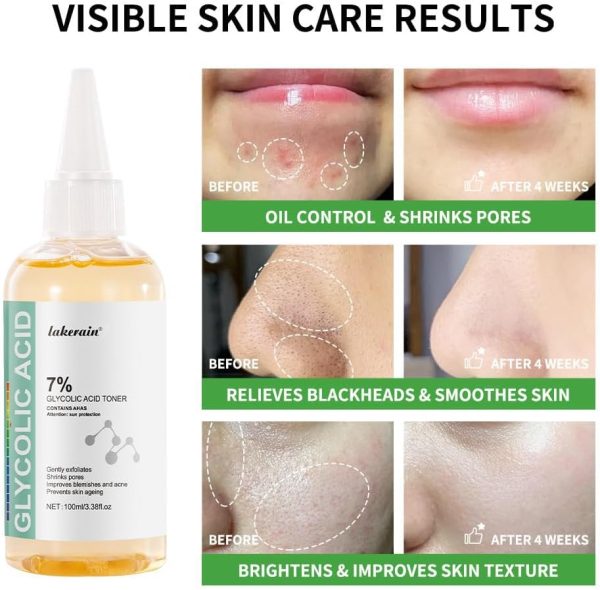 ⁦Azonee Glycolic Acid Toner, Glycolic Acid 7% Toning Solution, 100ml Glycolic Acid 7% Exfoliating Toner, Glycolic Acid Serum, Gently Exfoliates,Smooths Skin Texture,Control Skin Water and Oil Balance⁩ - الصورة ⁦3⁩