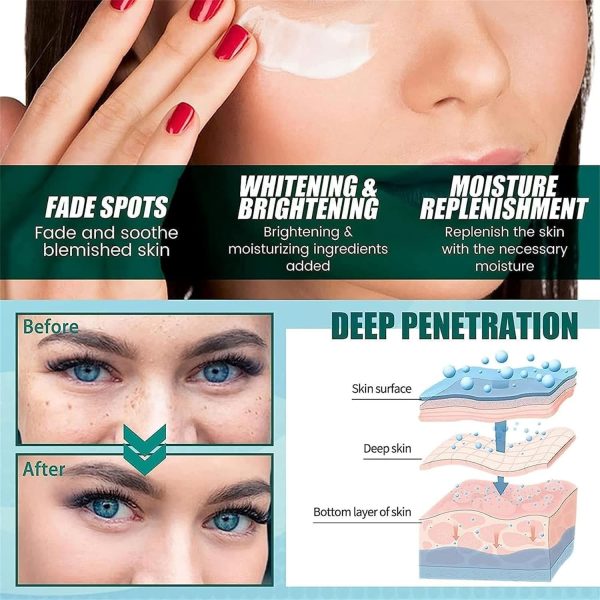 ⁦ALEjon Japanese Melasma Cream,Dr Hancy White Spot Cream China,Melasma Japanese Cream,Hancy Yunnan Melasma Cream,Japanese Melasma Cream Dark Spots Remover,Skin Care Facial Moisturizer Face Cream (2)⁩ - الصورة ⁦6⁩
