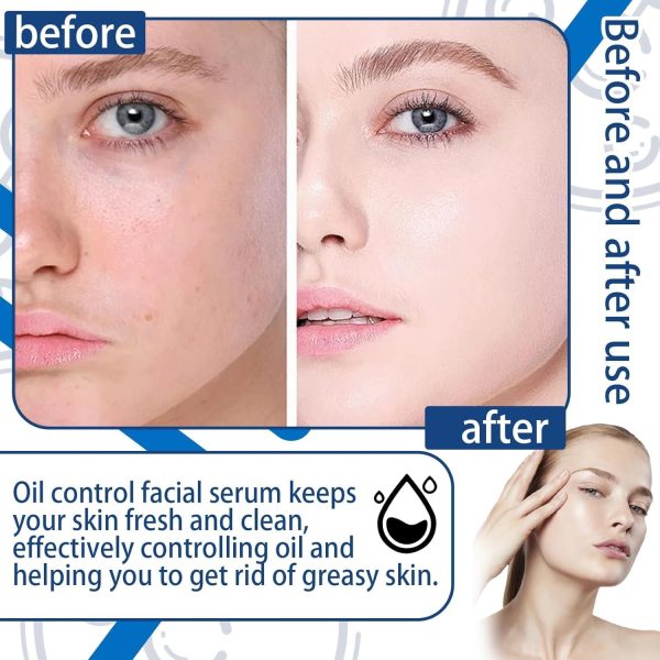 ⁦Azonee Face Serum Mask, Hydrating Face Skincare Serum, B5 Mask with Salicylic Acid, Korean Mask, Light Oil Control Face Serum, Face Moisturizer⁩ - الصورة ⁦5⁩
