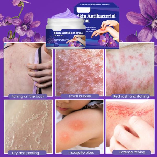 ⁦HONPOLO Skin Antibacterial Cream, Soothing Relief for Itching & Discomfort from Insect Bites, Rashes, Skin Irritations, 20g Moisturizing Cream for Effective Skin Care, for Mosquito Bites, Dry Skin⁩ - الصورة ⁦7⁩