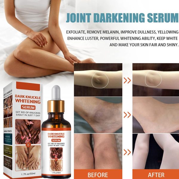 ⁦KOAHDE Hand Knuckle Whitening Serums,Knuckle Skin Lightening Serums,Dark Knuckle Whitening Serums,Dark Knuckle Corrector Serums,Removing Dark Spots Essence,Acanthosis Nigricans Whitening Oil,50ML⁩ - الصورة ⁦5⁩