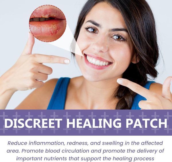 ⁦JDLYEVER Lip Care Patches 36Pcs for Treating Dry, Chapped, or Damaged Lips, Moisturizing and Nourishing Formula, Effective Smoothing and Repair, Comfortable and Non-Irritating, Fast-Acting Relief⁩ - الصورة ⁦3⁩