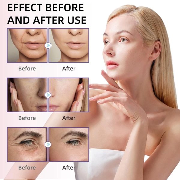 ⁦سيروم سينتيلا اسياتيكا المرطب لتفتيح البشرة من سينتيلا، سيروم وجه سينتيلا مع حمض الهيالورونيك، سيروم وجه مضاد للشيخوخة ومضاد للتجاعيد، سيروم سينتيلا لاستعادة الوجه، امبول سينتيلا⁩ - الصورة ⁦2⁩