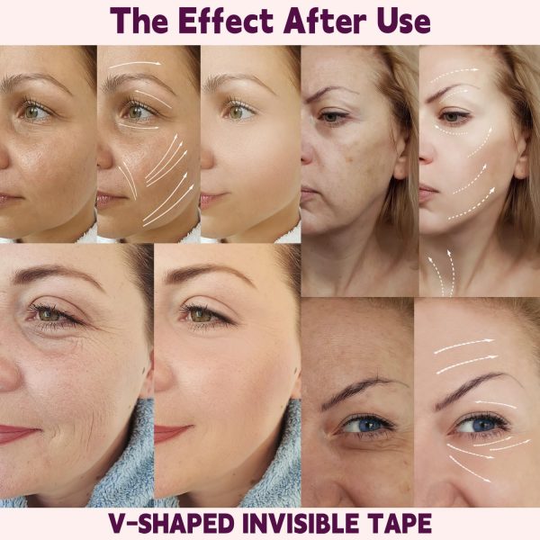 ⁦200 Pcs Face Lift Tape, Facelift Tape for Face Invisible, Creates v-Shaped Face, Makeup Face Lift Tools for Lifting Eyes Neck Double Chin⁩ - الصورة ⁦5⁩