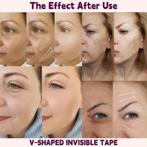 200 Pcs Face Lift Tape, Facelift Tape for Face Invisible, Creates v-Shaped  Face, Makeup Face Lift Tools for Lifting Eyes Neck Double Chin | حراج ديلز