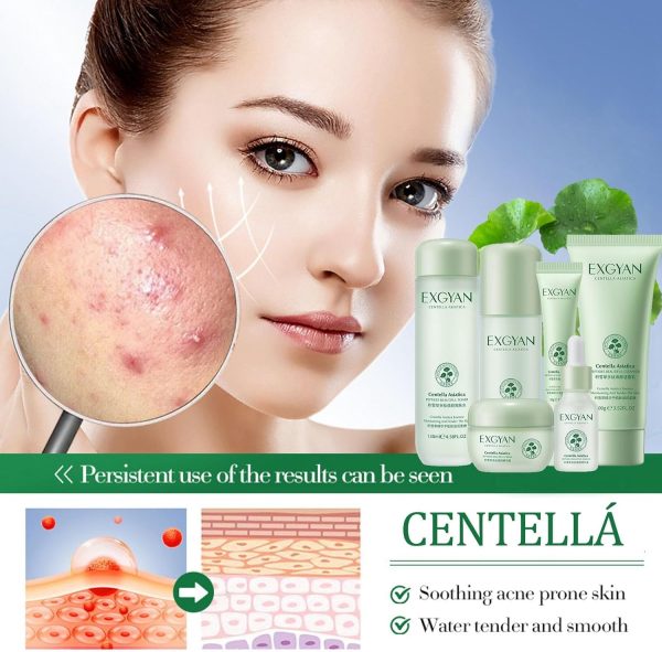 ⁦KASTWAVE Teen Skin Care Kit, Centellá 6-In-1 Skincare Gift Set, Facial kit, Cleaning and Oil Control, Soothing, Boosting Collagen & Hydrating For Women, Birthday Gifts Set For Teen Girls⁩ - الصورة ⁦4⁩