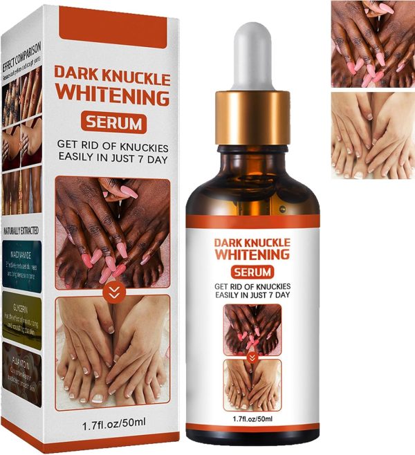 KOAHDE Hand Knuckle Whitening Serums,Knuckle Skin Lightening Serums,Dark Knuckle Whitening Serums,Dark Knuckle Corrector Serums,Removing Dark Spots Essence,Acanthosis Nigricans Whitening Oil,50ML