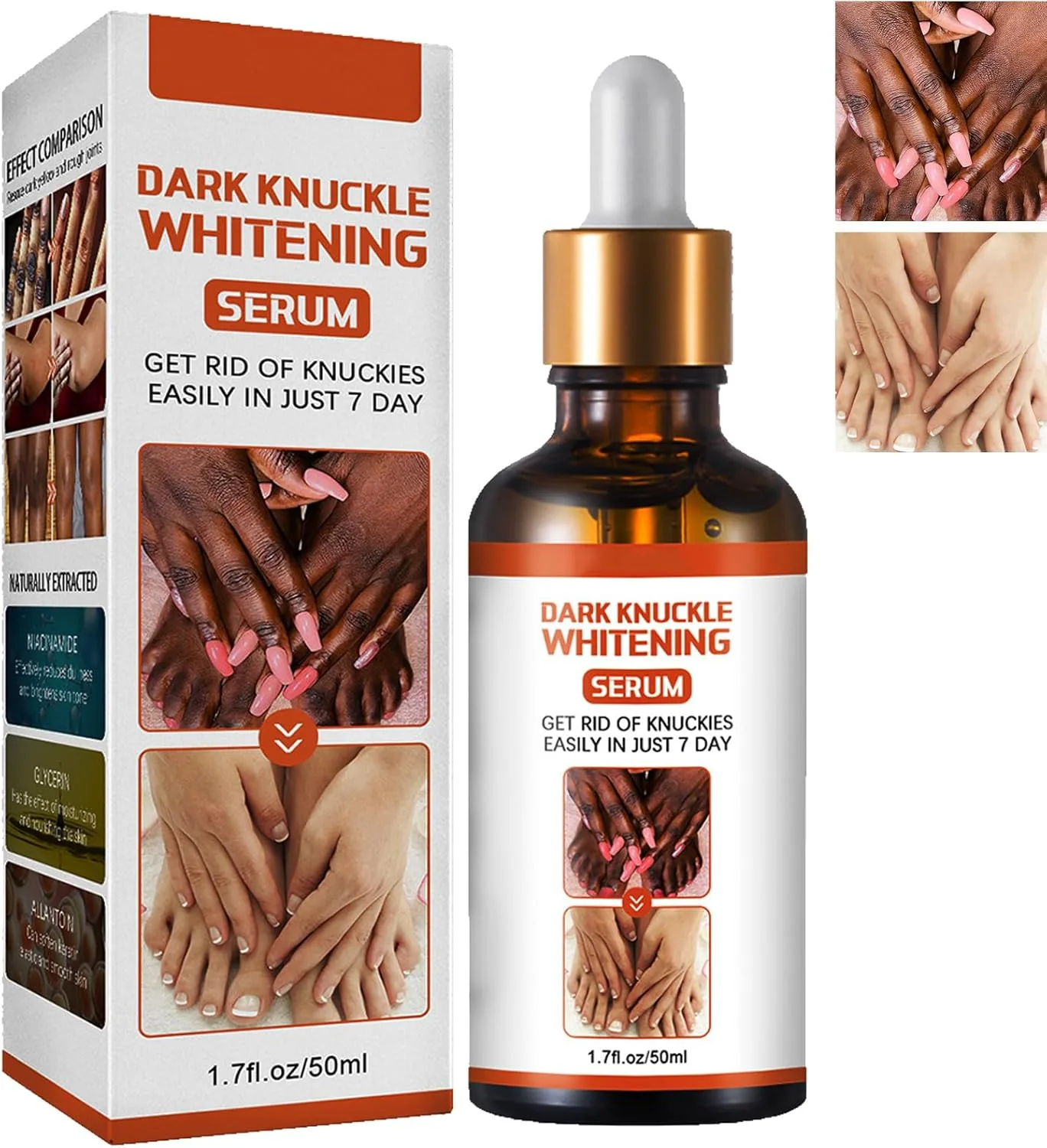 KOAHDE Hand Knuckle Whitening Serums,Knuckle Skin Lightening Serums,Dark Knuckle Whitening Serums,Dark Knuckle Corrector Serums,Removing Dark Spots Essence,Acanthosis Nigricans Whitening Oil,50ML
