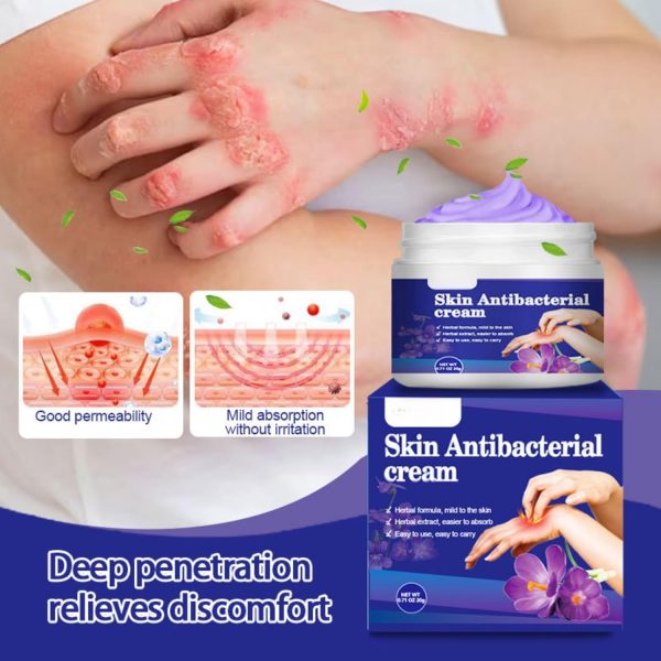 ⁦HONPOLO Skin Antibacterial Cream, Soothing Relief for Itching & Discomfort from Insect Bites, Rashes, Skin Irritations, 20g Moisturizing Cream for Effective Skin Care, for Mosquito Bites, Dry Skin⁩ - الصورة ⁦2⁩