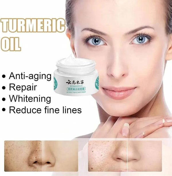 ⁦ALEjon Japanese Melasma Cream,Dr Hancy White Spot Cream China,Melasma Japanese Cream,Hancy Yunnan Melasma Cream,Japanese Melasma Cream Dark Spots Remover,Skin Care Facial Moisturizer Face Cream (2)⁩ - الصورة ⁦7⁩