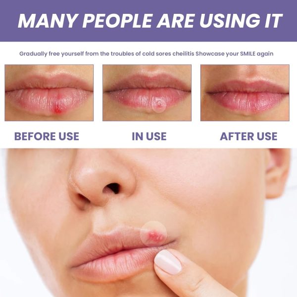 ⁦JDLYEVER Lip Care Patches 36Pcs for Treating Dry, Chapped, or Damaged Lips, Moisturizing and Nourishing Formula, Effective Smoothing and Repair, Comfortable and Non-Irritating, Fast-Acting Relief⁩ - الصورة ⁦5⁩