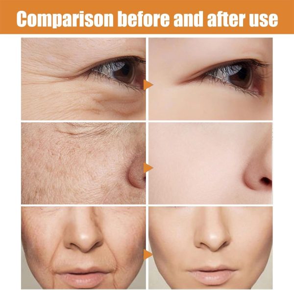⁦Organic Frankincense Resin Oil,Face Frankincense R/esin Oil,Fra/nkincense O/il for Skin,Frankincens/e Res-in to Reduces Fine Lines and Wrinkles,Moisturizing Frankinc-ense Resin O-il for Skin⁩ - الصورة ⁦2⁩