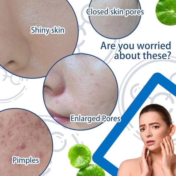 ⁦Azonee Face Serum Mask, Hydrating Face Skincare Serum, B5 Mask with Salicylic Acid, Korean Mask, Light Oil Control Face Serum, Face Moisturizer⁩ - الصورة ⁦3⁩
