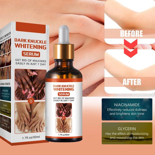 ⁦KOAHDE Hand Knuckle Whitening Serums,Knuckle Skin Lightening Serums,Dark Knuckle Whitening Serums,Dark Knuckle Corrector Serums,Removing Dark Spots Essence,Acanthosis Nigricans Whitening Oil,50ML⁩ - الصورة ⁦2⁩