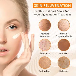 KASTWAVE Face Dark Spot Remover, Skin Brightening Gel Cream for Body, Underarms, Armpit, Knees, Elbows, Sensitive Area, with Niacinamide, Vitamin C, Citric Acid, Green Tea, and Shea Butter
