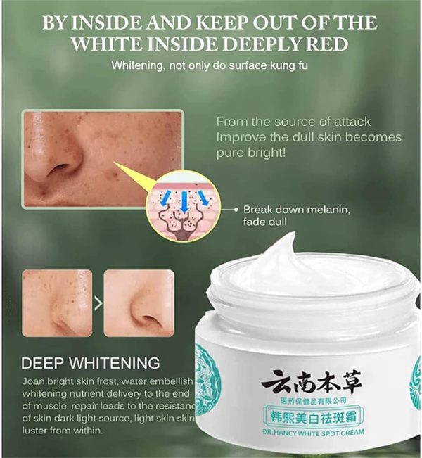 ⁦ALEjon Japanese Melasma Cream,Dr Hancy White Spot Cream China,Melasma Japanese Cream,Hancy Yunnan Melasma Cream,Japanese Melasma Cream Dark Spots Remover,Skin Care Facial Moisturizer Face Cream (2)⁩ - الصورة ⁦2⁩