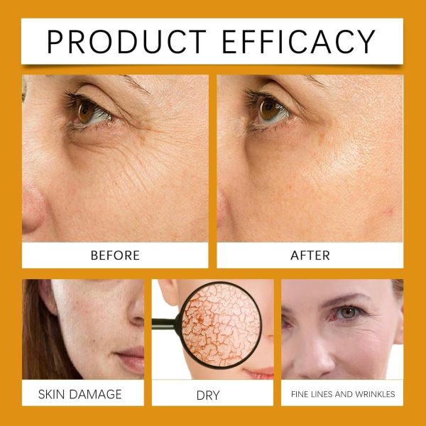 ⁦Organic Frankincense Resin Oil,Face Frankincense R/esin Oil,Fra/nkincense O/il for Skin,Frankincens/e Res-in to Reduces Fine Lines and Wrinkles,Moisturizing Frankinc-ense Resin O-il for Skin⁩ - الصورة ⁦6⁩