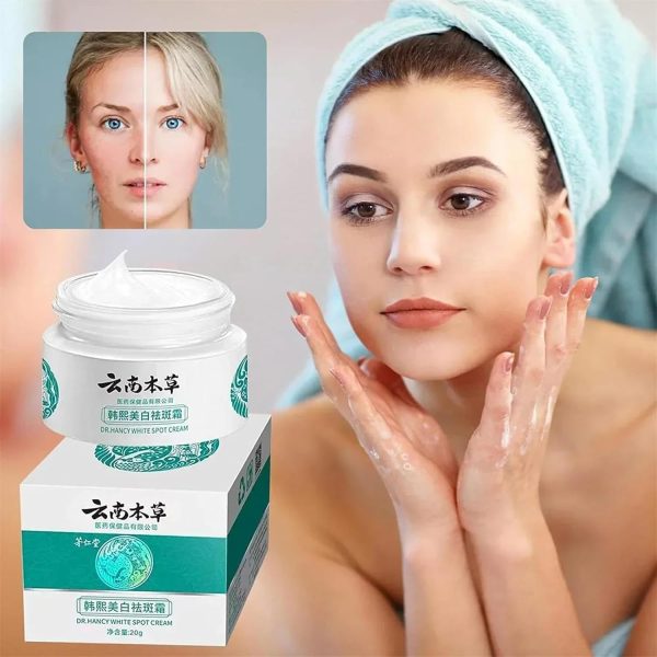 ⁦ALEjon Japanese Melasma Cream,Dr Hancy White Spot Cream China,Melasma Japanese Cream,Hancy Yunnan Melasma Cream,Japanese Melasma Cream Dark Spots Remover,Skin Care Facial Moisturizer Face Cream (2)⁩ - الصورة ⁦5⁩