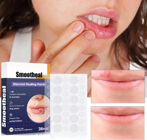 JDLYEVER Lip Care Patches 36Pcs for Treating Dry, Chapped, or Damaged Lips, Moisturizing and Nourishing Formula, Effective Smoothing and Repair, Comfortable and Non-Irritating, Fast-Acting Relief