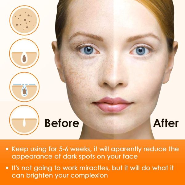 ⁦KASTWAVE Face Dark Spot Remover, Skin Brightening Gel Cream for Body, Underarms, Armpit, Knees, Elbows, Sensitive Area, with Niacinamide, Vitamin C, Citric Acid, Green Tea, and Shea Butter⁩ - الصورة ⁦2⁩