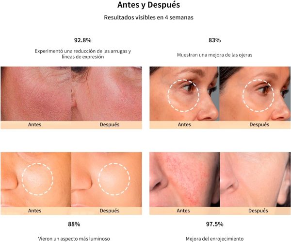 ⁦JOVS 4D Laser Light Therapy Mask, Red Light Therapy for Face with 4 Different Wavelength Adopted FPT Concentrated Technology, 3 Modes Portable Face Mask for Anti-aging⁩ - الصورة ⁦7⁩