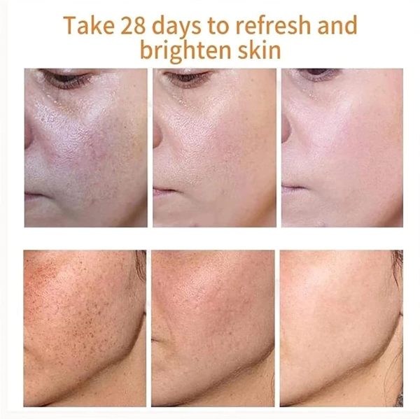 ⁦ALEjon Japanese Melasma Cream,Dr Hancy White Spot Cream China,Melasma Japanese Cream,Hancy Yunnan Melasma Cream,Japanese Melasma Cream Dark Spots Remover,Skin Care Facial Moisturizer Face Cream (2)⁩ - الصورة ⁦3⁩