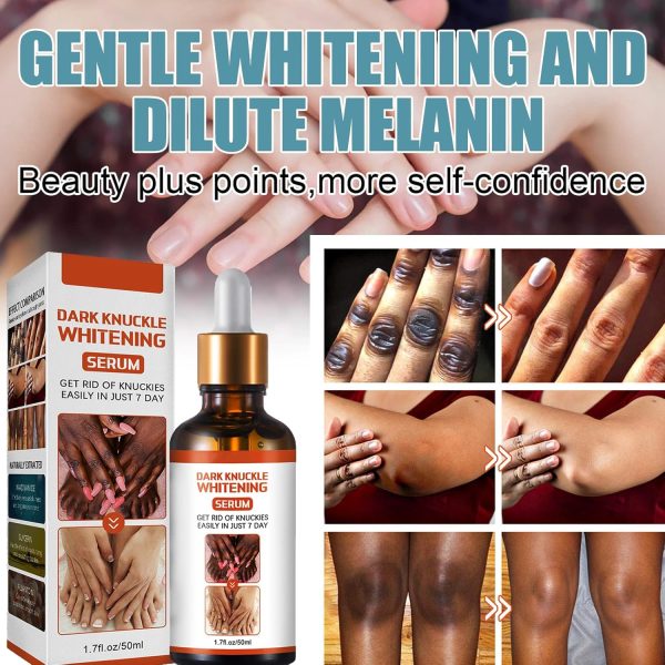 ⁦KOAHDE Hand Knuckle Whitening Serums,Knuckle Skin Lightening Serums,Dark Knuckle Whitening Serums,Dark Knuckle Corrector Serums,Removing Dark Spots Essence,Acanthosis Nigricans Whitening Oil,50ML⁩ - الصورة ⁦3⁩
