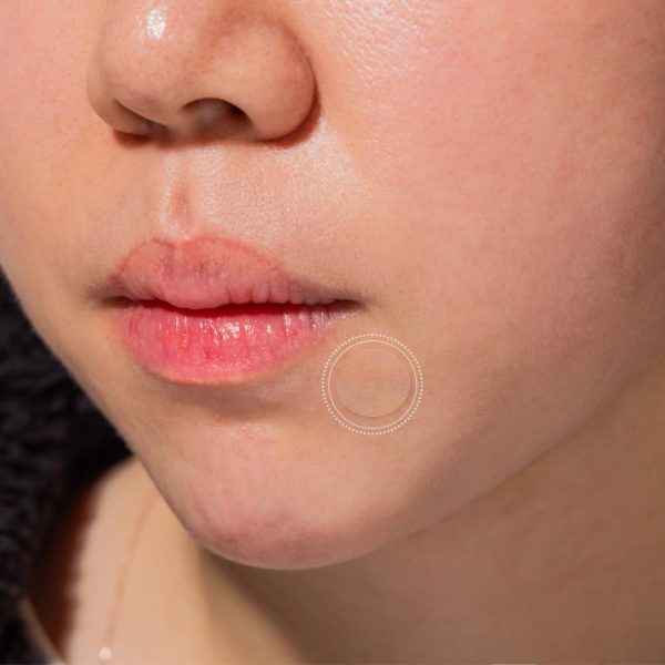 ⁦PATCH PRO Easy Roll Spot Patch - Korean Skin Care Dispenser, Invisible Hydrocolloid Patches, Significantly Reduced Pimples, Invisible Skin Covers, Skin Care for Impurities (Pack of 70)⁩ - الصورة ⁦5⁩