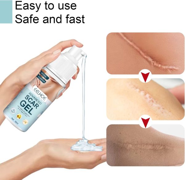 ⁦JDLYEVER Fade Scar Gel 50ml Surgical Scars Skin Hyperplasia Burning Nursing Care Smoothing Scars Repairing Scars, Moisturizing & Hydrating Ingredients Soothe & Nurture Skin, Non-Greasy All Skin Types⁩ - الصورة ⁦3⁩