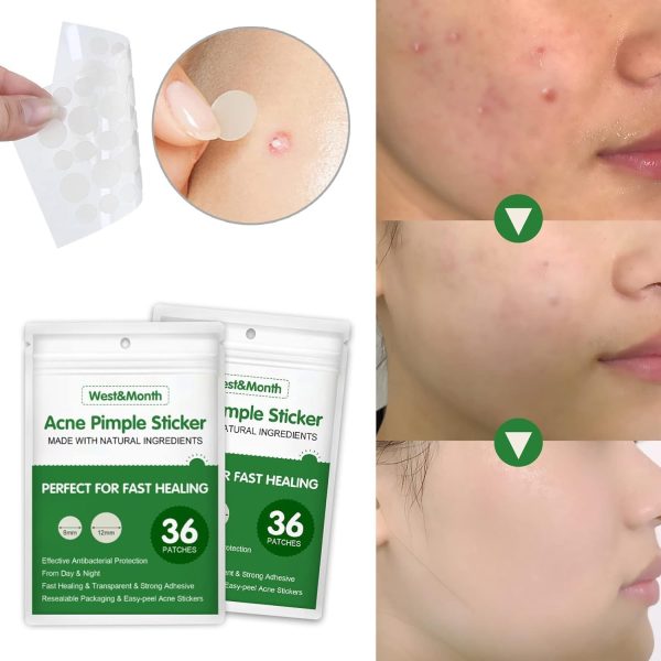 ⁦Salasabil Transparent Acne Remover Pimple Absorbing Cover Blemish Spot Skin Care Facial Stickers 2 Sizes (36 Count) in two boxs⁩ - الصورة ⁦3⁩