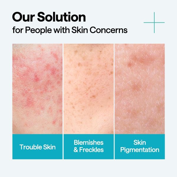 ⁦Mediheal Madecassoside Repair Serum, 1.35 Fl.Oz (40 Ml) | Blemish Care, Fades Pigmentation And Freckles & Skin Soothing & Hydration | With Centella Asiatica, Niacinamide⁩ - الصورة ⁦4⁩