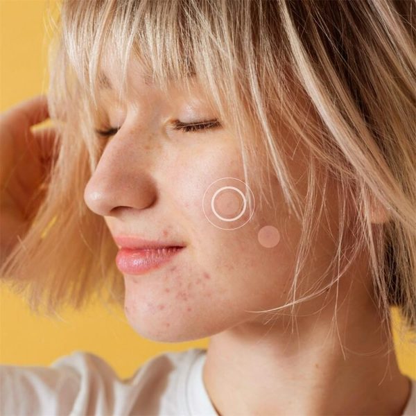 ⁦Acne Pimple Patch, Absorbing Hydrocolloid Original, Hydrocolloid Acne Pimple Patch, Patches for Blemishes and Zits Cover, Spot Stickers for Face and Body, 3 Size, Vegan and Cruelty Free (10 Count)⁩ - الصورة ⁦4⁩