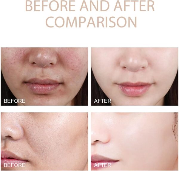 ⁦Bonseor Quarxery Purifying Exfoliating Gel - Face & Body Exfoliating Scrub Gel for All Skin Types (1 PCS)⁩ - الصورة ⁦2⁩