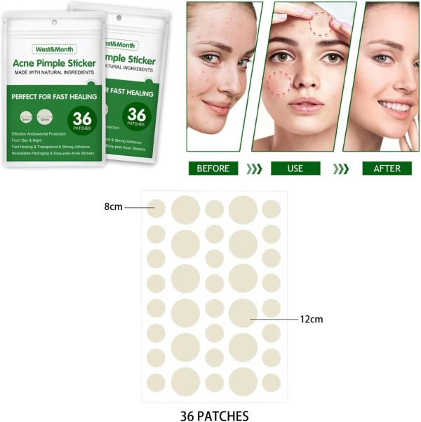 ⁦Salasabil Transparent Acne Remover Pimple Absorbing Cover Blemish Spot Skin Care Facial Stickers 2 Sizes (36 Count) in two boxs⁩ - الصورة ⁦2⁩