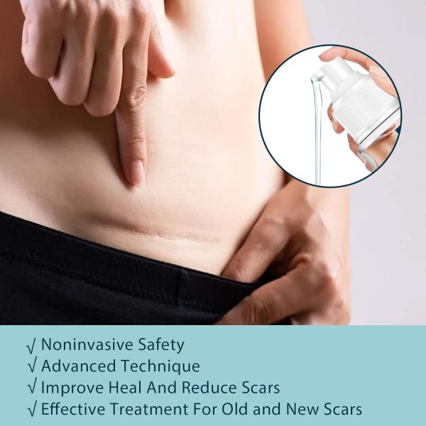 ⁦JDLYEVER Fade Scar Gel 50ml Surgical Scars Skin Hyperplasia Burning Nursing Care Smoothing Scars Repairing Scars, Moisturizing & Hydrating Ingredients Soothe & Nurture Skin, Non-Greasy All Skin Types⁩ - الصورة ⁦6⁩