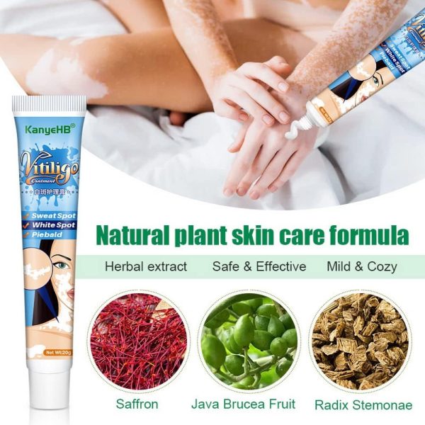 ⁦Vitiligo Cream, Vitiligo Treatment, Vitiligo Care Cream for Skin Vitiligo, Psoriasis, Leukoplakia, Reduces White Spots, Improve Skin Pigmentation Regulating (Pack of 1)⁩ - الصورة ⁦4⁩