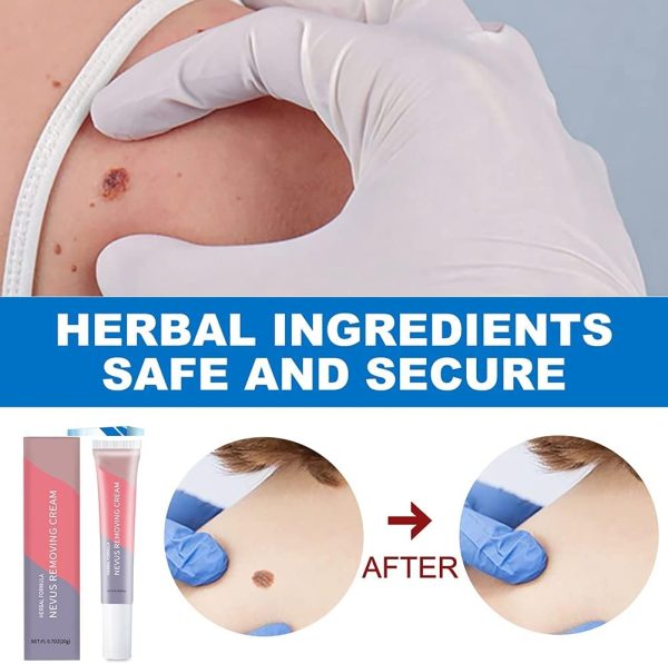 ⁦Skin Tag Remover, Warts & Mole Remover Cream- Quickly and Easily Remove Common Skin Tag, Wart and Callus - Enriched with All Natural Ingredients,Effective and Scar-Fre.⁩ - الصورة ⁦7⁩