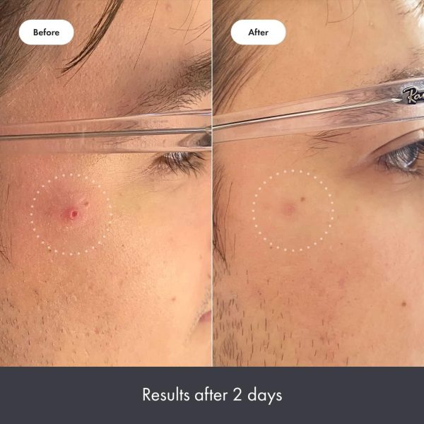 ⁦Hero Cosmetics Rescue Balm, Post Blemish Recovery Cream (0.507fl.oz / 15ml)⁩ - الصورة ⁦5⁩