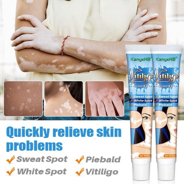 ⁦Vitiligo Cream, Vitiligo Treatment, Vitiligo Care Cream for Skin Vitiligo, Psoriasis, Leukoplakia, Reduces White Spots, Improve Skin Pigmentation Regulating (Pack of 1)⁩ - الصورة ⁦2⁩