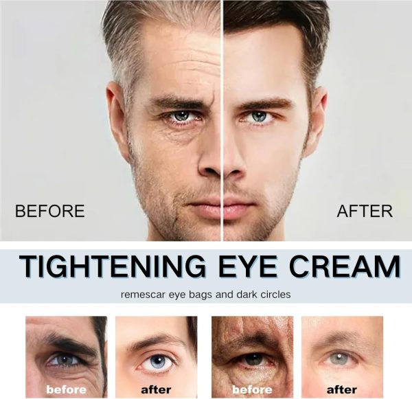 ⁦Azonee Eye Serum For Men, Caffeine Eye Cream for Instant Tightening, Lifting & Firming, Anti-Wrinkle Hyaluronic Acid Moisturizer, Kojic Acid Depuffing Eye Gel⁩ - الصورة ⁦5⁩
